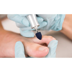 Pointed abrasive caps x10 1003 - Diamond - Coarse grain - Abrasion of corns, calluses and hyperkeratoses - 10 mm Ruck