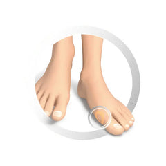 Protection for Hallux - Silicone protection rings - Ruck Ruck